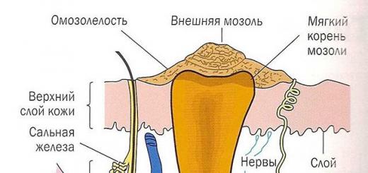 На заметку: как избавиться от натоптышей на ступнях в домашних условиях и удалить их раз и навсегда?